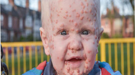 foto: caters_ News Agency