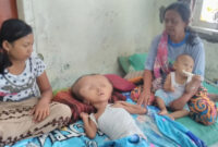 Muhammad Arif (11) Warga Perumahan Cerme Bumi Apsari Blok II/16, Desa Ngabetan, Cerme, Gresik hanya mampu tidur terlentang di kasur kusut. Dia perlu pertolongan.