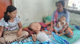 Muhammad Arif (11) Warga Perumahan Cerme Bumi Apsari Blok II/16, Desa Ngabetan, Cerme, Gresik hanya mampu tidur terlentang di kasur kusut. Dia perlu pertolongan.