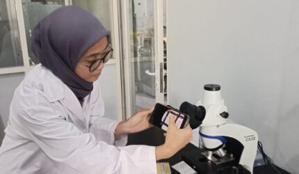 Penelitian ECOTON dan FK UNAIR menemukan mikroplastik dalam urin dan air ketuban ibu hamil di Gresik.